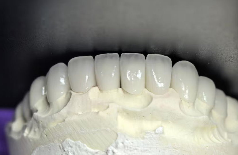 Polychromatic Zirconia